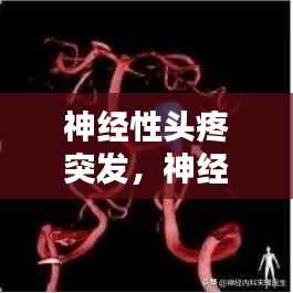 神经性头疼突发,神经性头疼发作怎么减轻症状