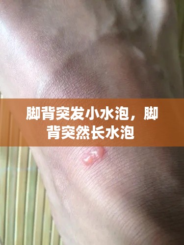 脚背突发小水泡,脚背突然长水泡